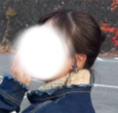 Mさん画像