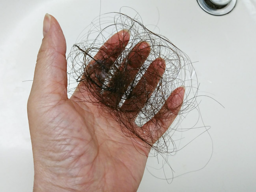 髪が抜ける原因を解説 異常な抜け毛の見分け方は 解決策や髪が抜けることで考えられる病気もご紹介します