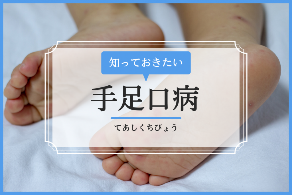 手足口病 イシャチョク
