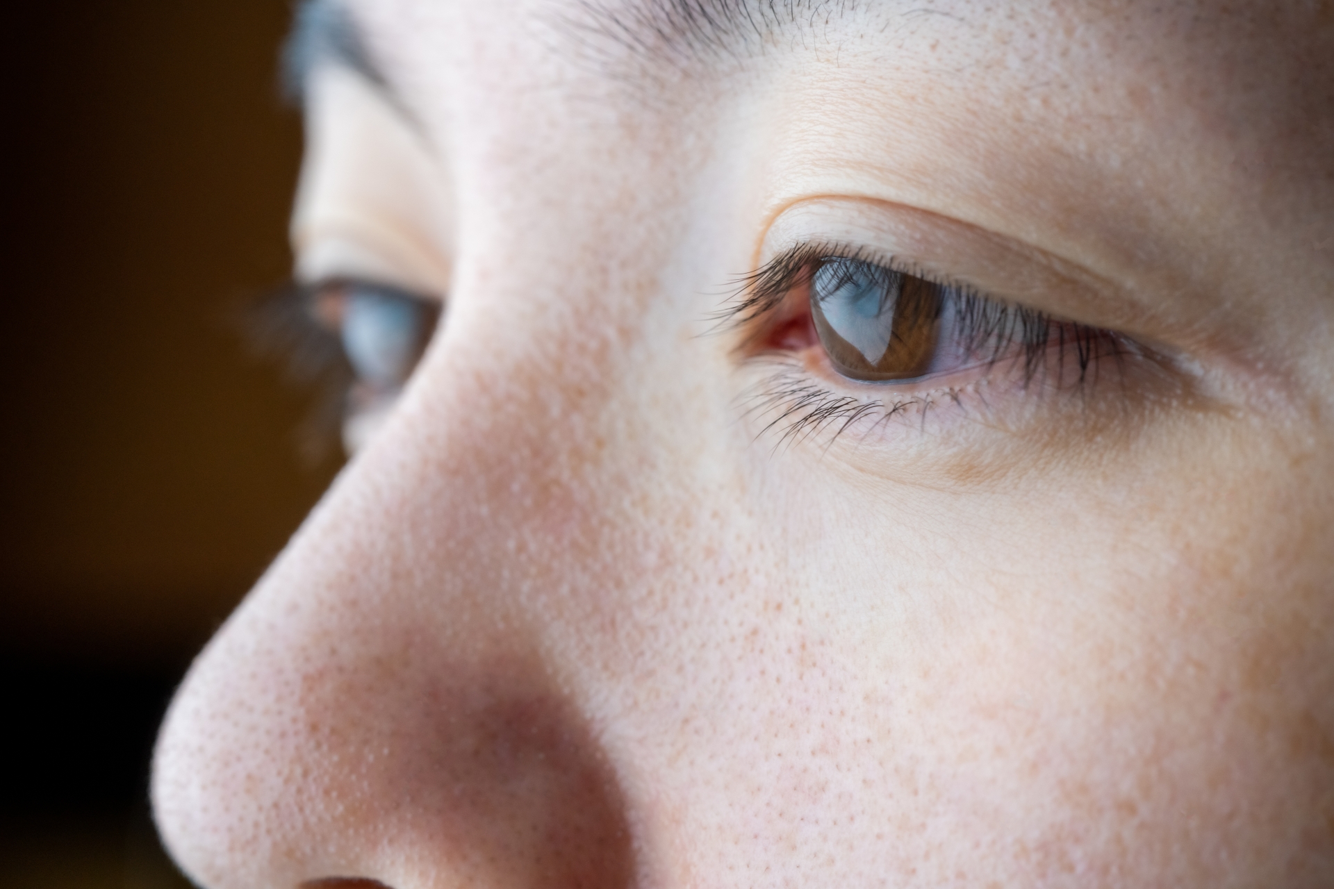 目のきわ 目のふちの白いできもの マイボーム腺梗塞とは イシャチョク