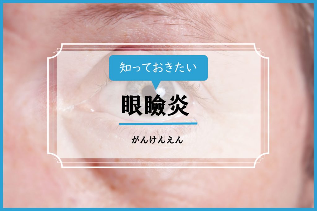 眼瞼炎【イシャチョク】