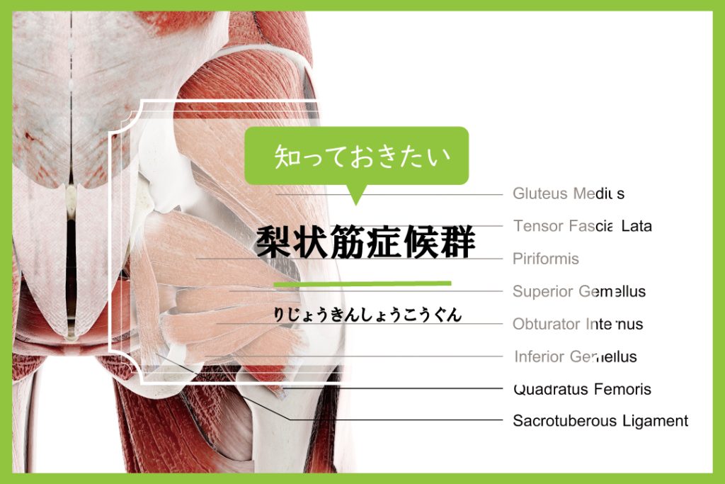 梨状筋症候群の症状